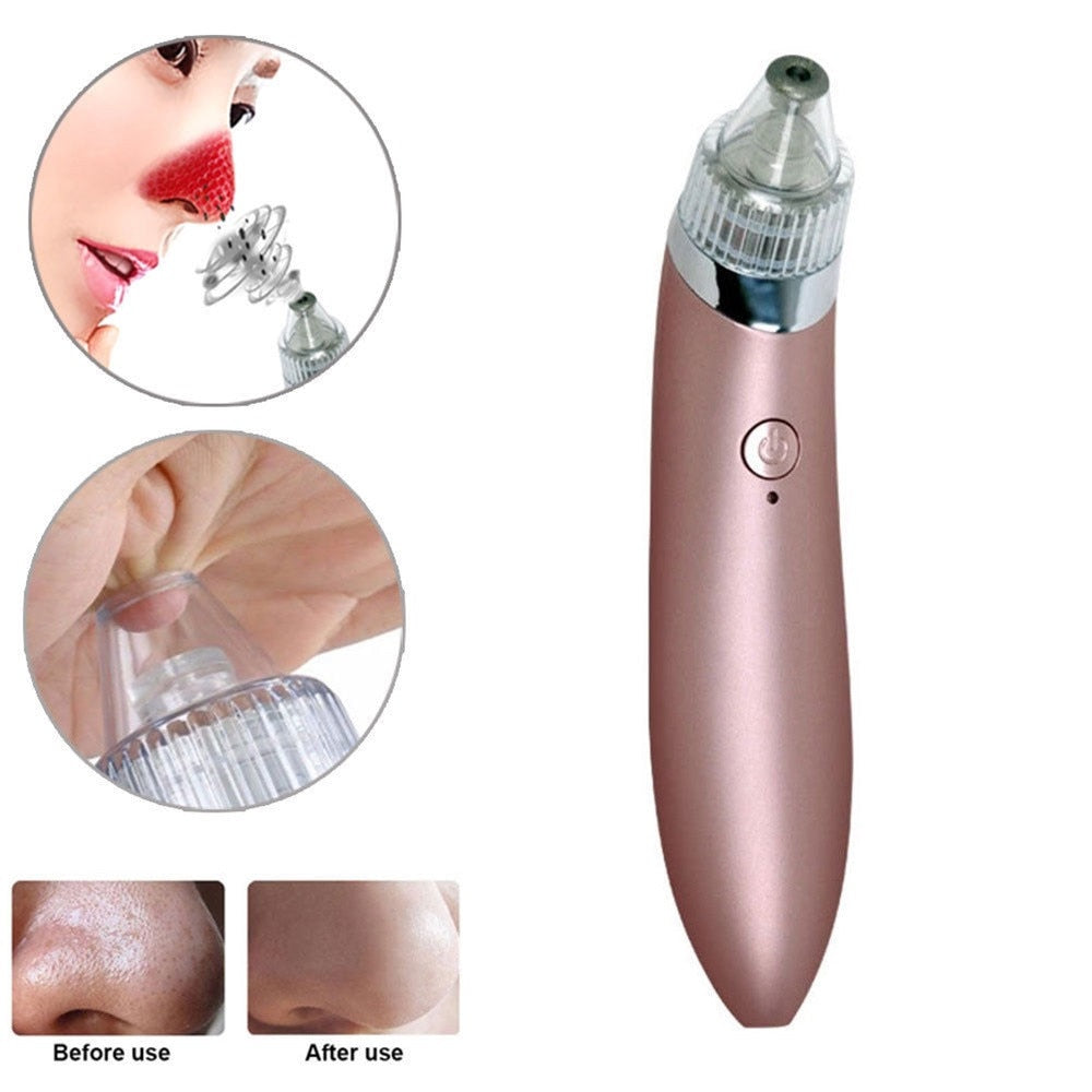 💨✨ Beauty Facial Machine | Blackhead Remover & Deep Pore Cleanser Device