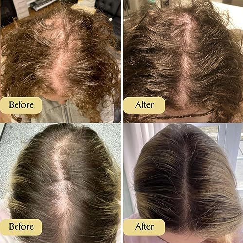 ✨ Moisturizing Repair Hair Care Essential Oil — Soft & Smooth Hair Treatment (60ml) 💆‍♀️🌿