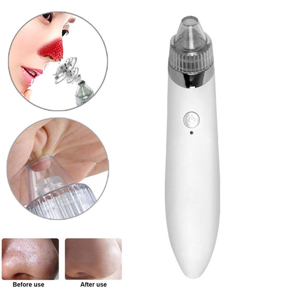 💨✨ Beauty Facial Machine | Blackhead Remover & Deep Pore Cleanser Device