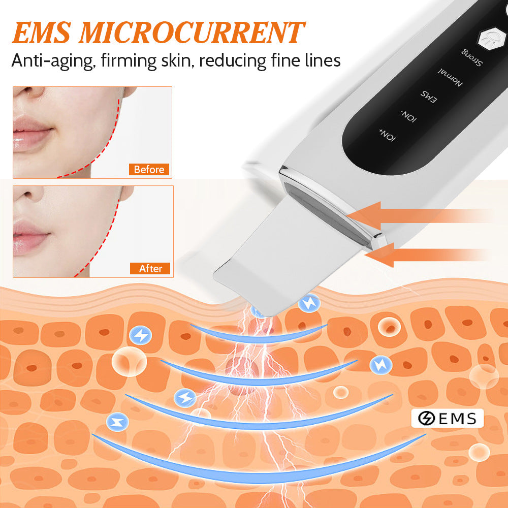 💖🌀 Ultrasonic Skin Spatula | Facial Pore & Blackhead Deep Cleansing Beauty Device