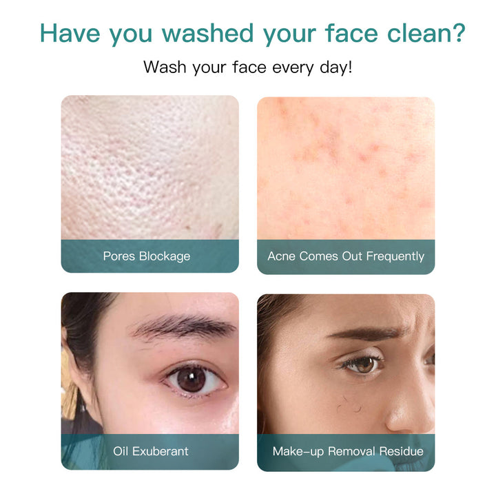 💖🧼 Multifunctional Face Washing Instrument | Electric Rotating Deep Cleansing Device