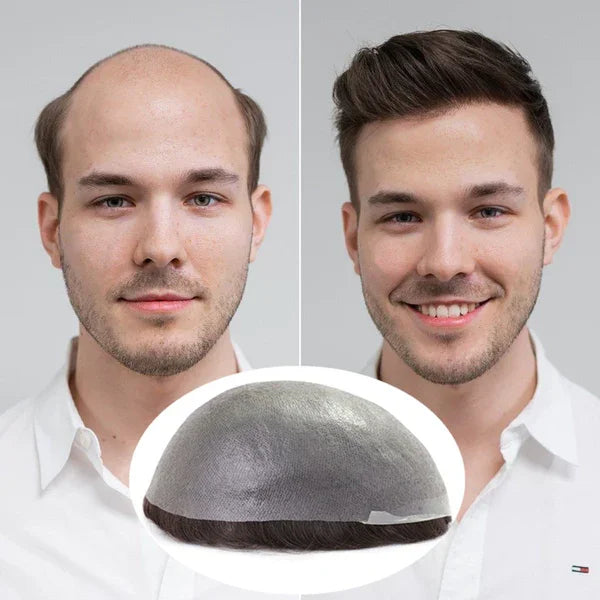 Thin Skin 0.03mm Natural Hair Men’s Toupee – Human Hair Replacement System