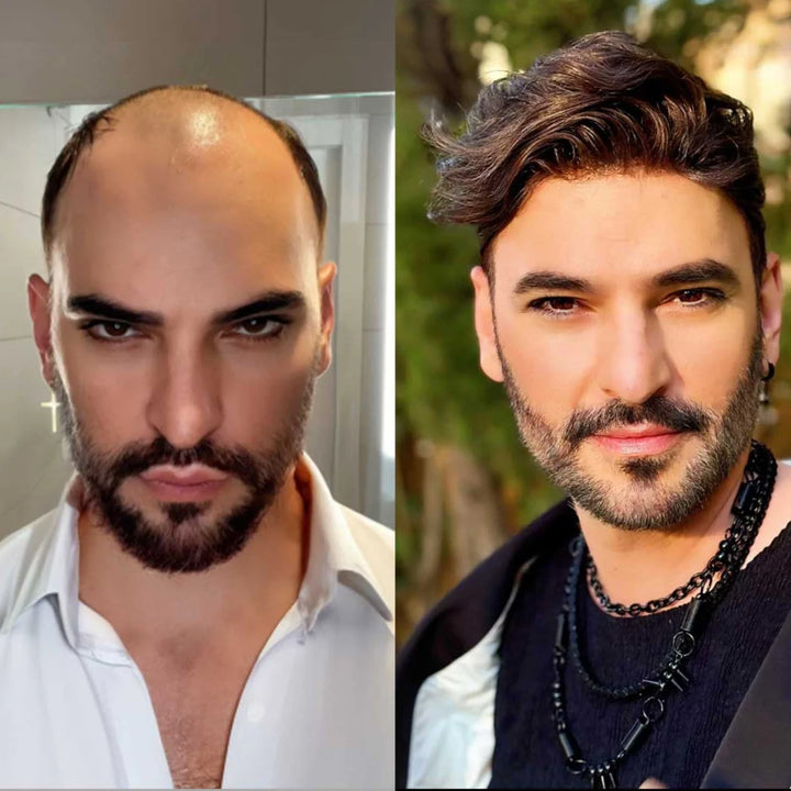 Australia Base Human Hair Men Toupee Breathable Middle Lace Men Capillary Prosthesis Male Wig Hair System Durable Knot Hairpiece